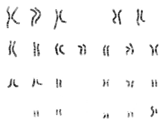 http://en.wikipedia.org/wiki/File:NHGRI_human_male_karyotype.png Diploid Cell